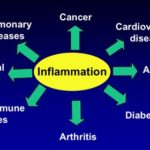 Study: Anti-inflammatory Action of Curcumin