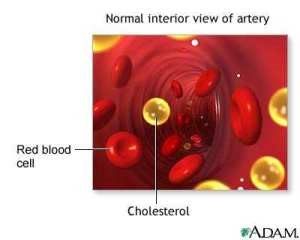 cholesterolnormal