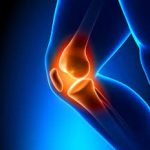 Knee Pain – Try Curcumall®