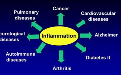 Study: Anti-inflammatory Action of Curcumin