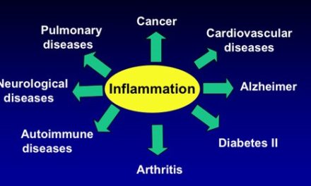 Study: Anti-inflammatory Action of Curcumin
